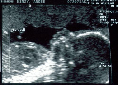 Zia In the Belly picture